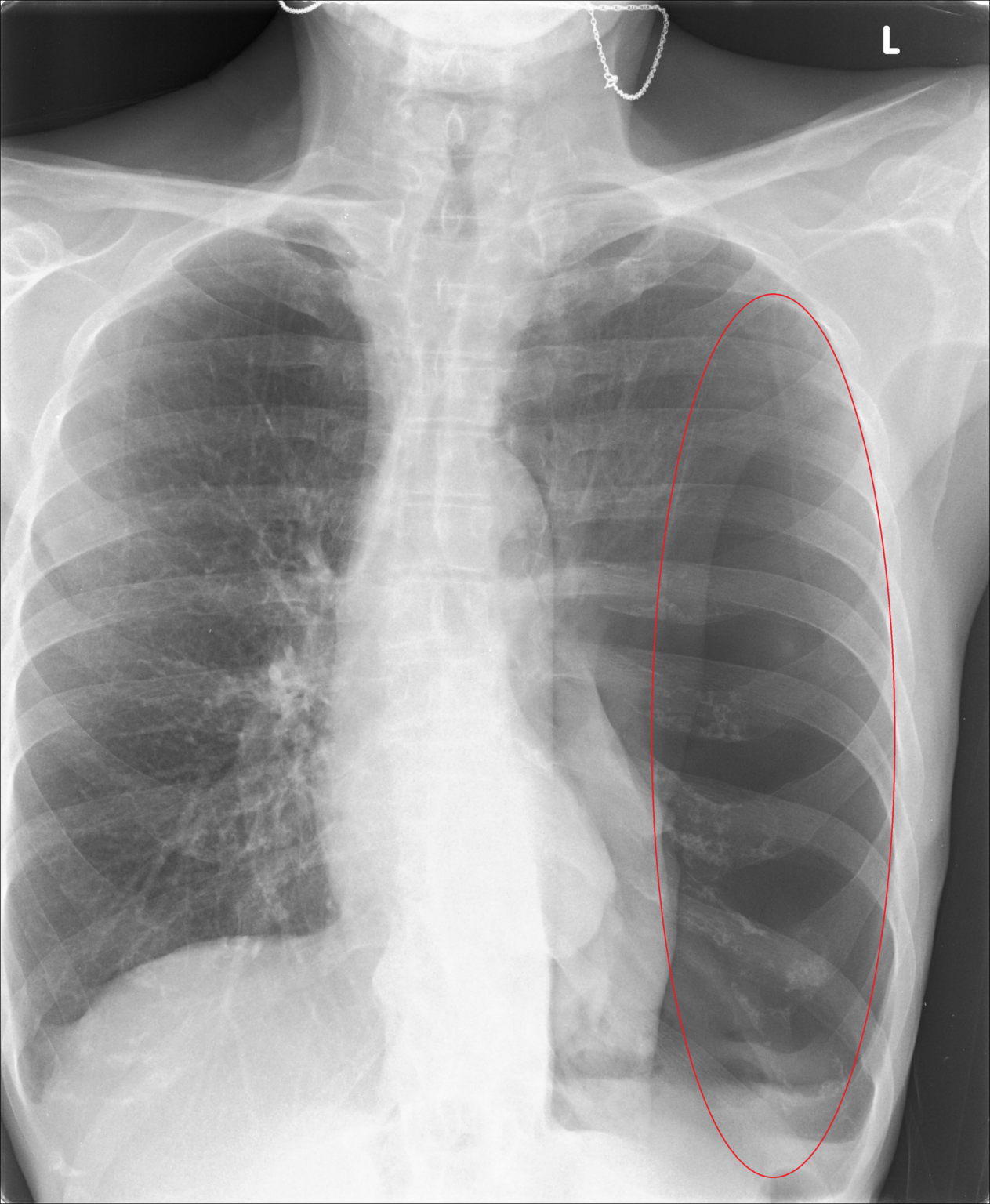 CXR Reading - DundeeChest